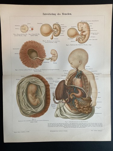 Antike grafik medizin - antike,
